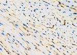 ARHGAP5 Antibody in Immunohistochemistry (Paraffin) (IHC (P))