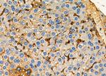 ARHGAP5 Antibody in Immunohistochemistry (Paraffin) (IHC (P))
