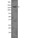 ARHGAP5 Antibody in Western Blot (WB)