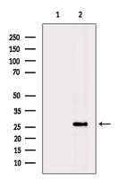 PPP1R1A Polyclonal Antibody