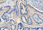 EPS15R Antibody in Immunohistochemistry (Paraffin) (IHC (P))