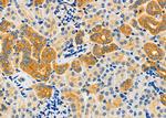 EPS15R Antibody in Immunohistochemistry (Paraffin) (IHC (P))