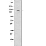 ABCG1 Polyclonal Antibody