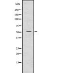 MMP20 Polyclonal Antibody