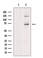 MMP21 Polyclonal Antibody