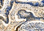IRS4 Antibody in Immunohistochemistry (Paraffin) (IHC (P))
