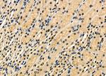 IRS4 Antibody in Immunohistochemistry (Paraffin) (IHC (P))