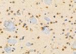 IRS4 Antibody in Immunohistochemistry (Paraffin) (IHC (P))