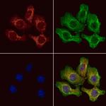 PRKD2 Polyclonal Antibody