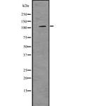 PRKD2 Antibody in Western Blot (WB)