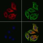 Aquaporin 7 Antibody in Immunocytochemistry (ICC/IF)
