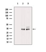 SRM Antibody in Western Blot (WB)