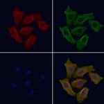 SLC39A8 Polyclonal Antibody