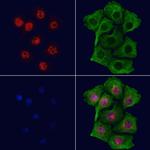 GLIS3 Antibody in Immunocytochemistry (ICC/IF)