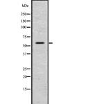 GLP1R Polyclonal Antibody