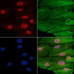 ZNF306 Polyclonal Antibody