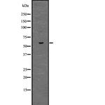 ZNF306 Antibody in Western Blot (WB)