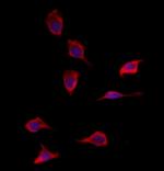 SOD3 Polyclonal Antibody