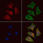 CD21 Polyclonal Antibody