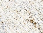Phospho-PKM2 (Ser37) Antibody in Immunohistochemistry (Paraffin) (IHC (P))