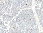 Phospho-PKM2 (Ser37) Antibody in Immunohistochemistry (Paraffin) (IHC (P))