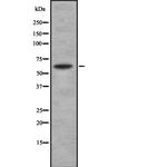 SOAT1 Antibody in Western Blot (WB)