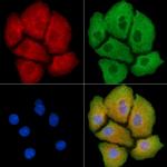 MYL12A Polyclonal Antibody