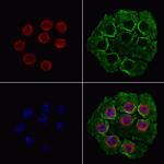 hnRNP UL1 Polyclonal Antibody