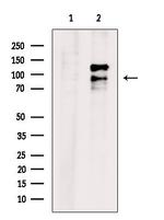 hnRNP UL1 Antibody in Western Blot (WB)