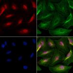 Cdc6 Polyclonal Antibody