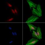 HB9 Polyclonal Antibody