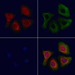 AP2S1 Polyclonal Antibody