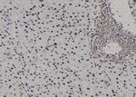 H3F3A Antibody in Immunohistochemistry (Paraffin) (IHC (P))