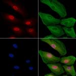 H3F3A Polyclonal Antibody