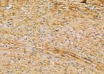SULT1A4 Antibody in Immunohistochemistry (Paraffin) (IHC (P))