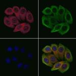 Lysozyme Polyclonal Antibody