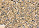 PUM1 Polyclonal Antibody