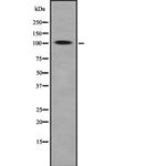 ROR2 Polyclonal Antibody