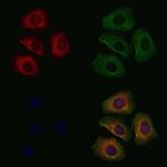 EYA2 Polyclonal Antibody