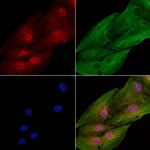 PHD1 Polyclonal Antibody