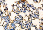 PHD1 Antibody in Immunohistochemistry (Paraffin) (IHC (P))