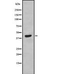 PHD1 Antibody in Western Blot (WB)