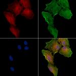 hCG beta-2 Polyclonal Antibody