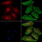 PIP Polyclonal Antibody