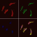 EHD1 Polyclonal Antibody