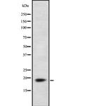 FDX1 Polyclonal Antibody