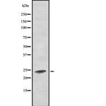 RALA Polyclonal Antibody