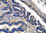 MESDC2 Antibody in Immunohistochemistry (Paraffin) (IHC (P))
