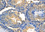 MESDC2 Antibody in Immunohistochemistry (Paraffin) (IHC (P))