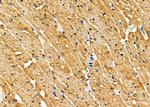 MESDC2 Antibody in Immunohistochemistry (Paraffin) (IHC (P))